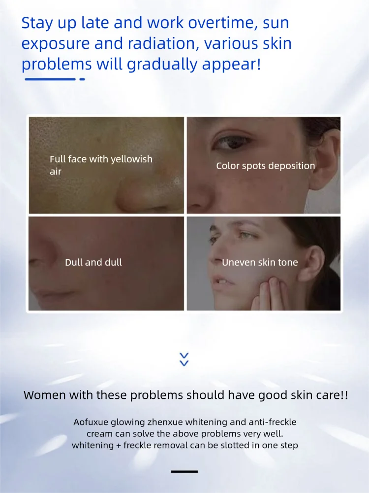 Whitening Freckle Corrector Cream